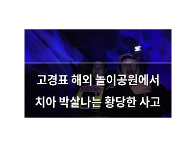 고경표 해외 놀이공원에서 치아 박살나는 황당한 사고