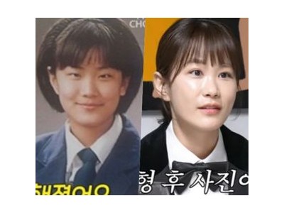 김준호 성형 사진 보고도 김지민 사랑꾼 발동
